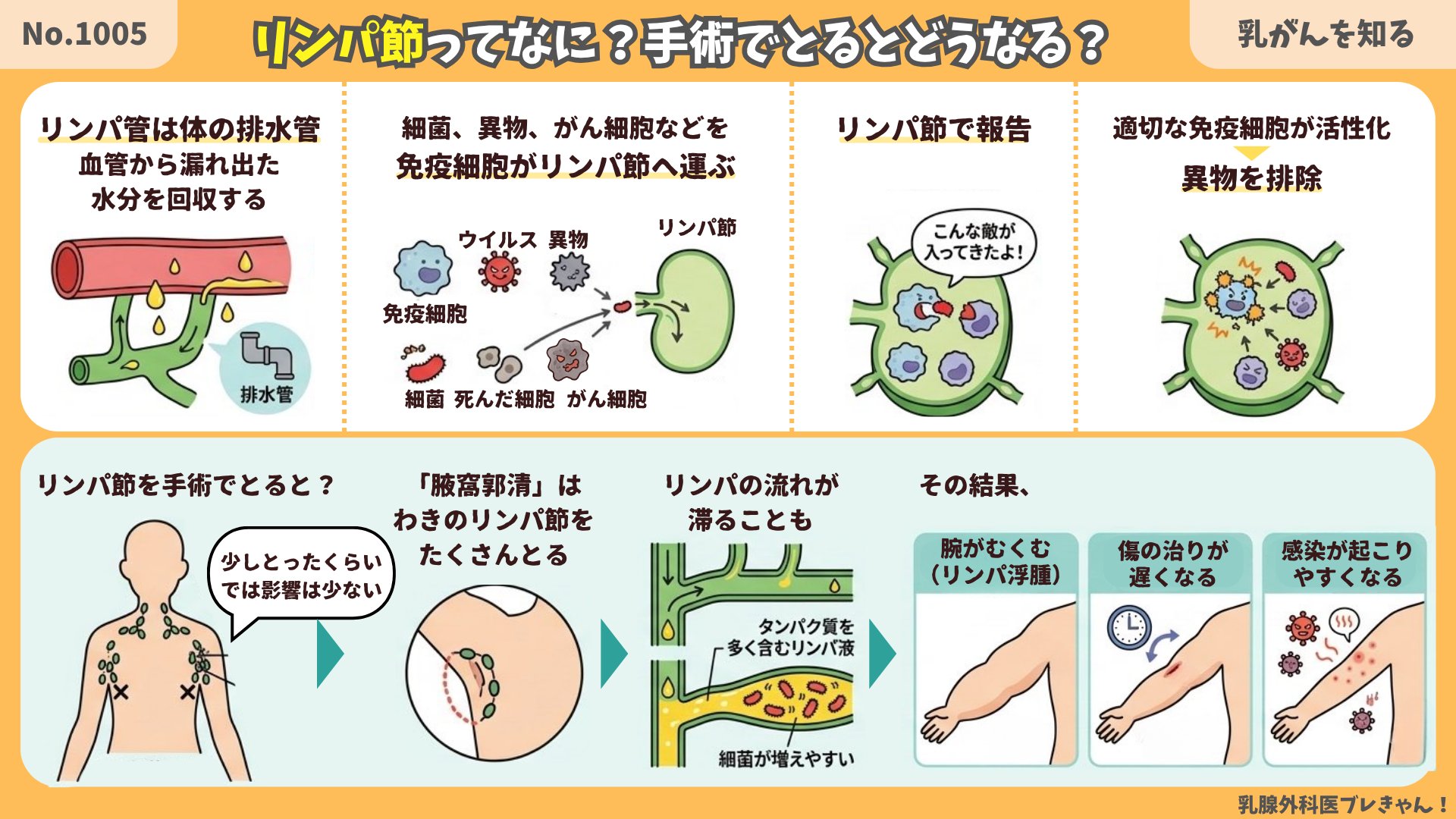 リンパ節ってなに？手術でとるとどうなる？